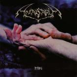 Anasarca - Dying